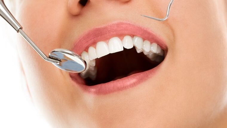 Dentysta Wrocław – gabinet stomatologiczny, któremu możesz zaufać